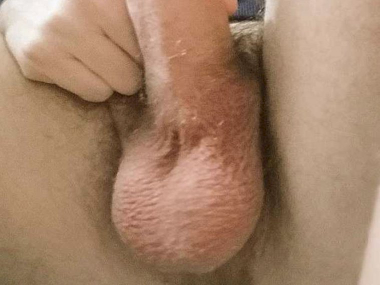 Antonoz's profile - Image n°2