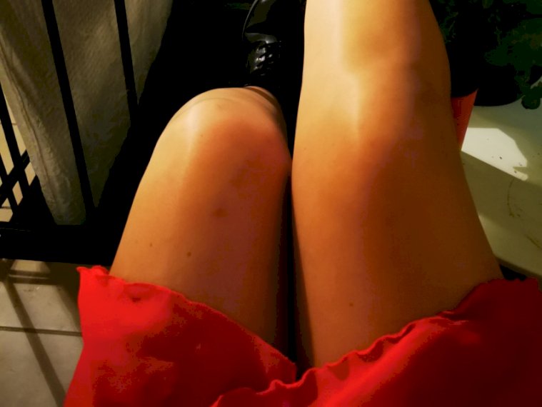 CherryCraft's profile - Image n°2
