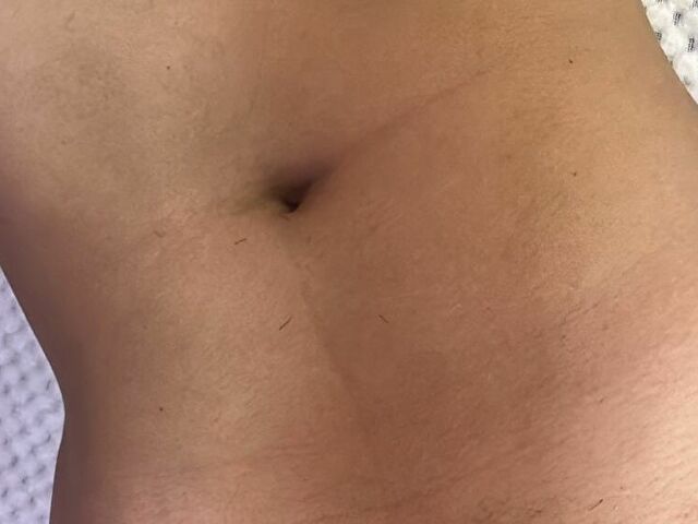 Perfil con Alaiacollway - Imagen  n°12