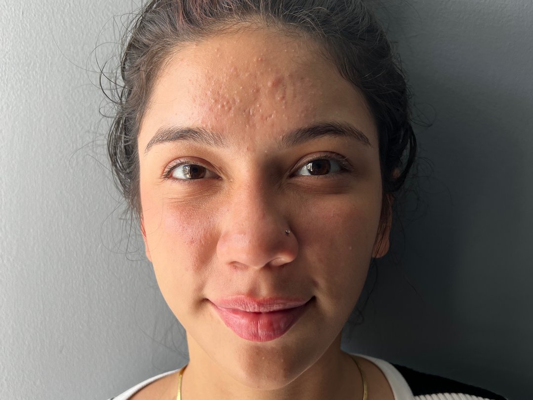 Amyglow_Pk's profile - Image n°0