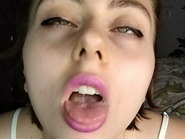 Perfil con Angidast - Imagen  n°9