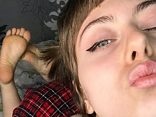 Perfil con Angidast - Imagen  n°7