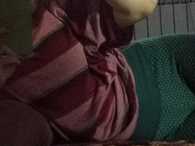 Perfil con Angidast - Imagen  n°5