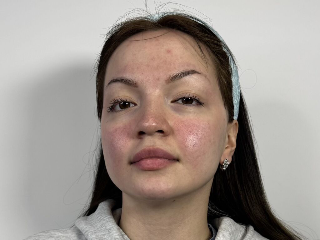 Perfil con Danringus - Imagen  n°1