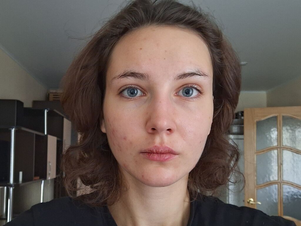 Perfil con Loycesanks - Imagen  n°0