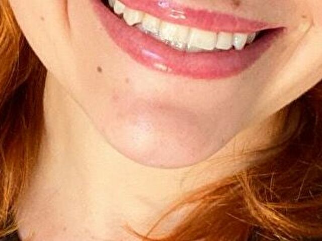 Perfil con Robijntje - Imagen  n°10