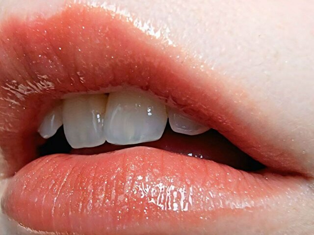 Shymistery's profile - Image n°24