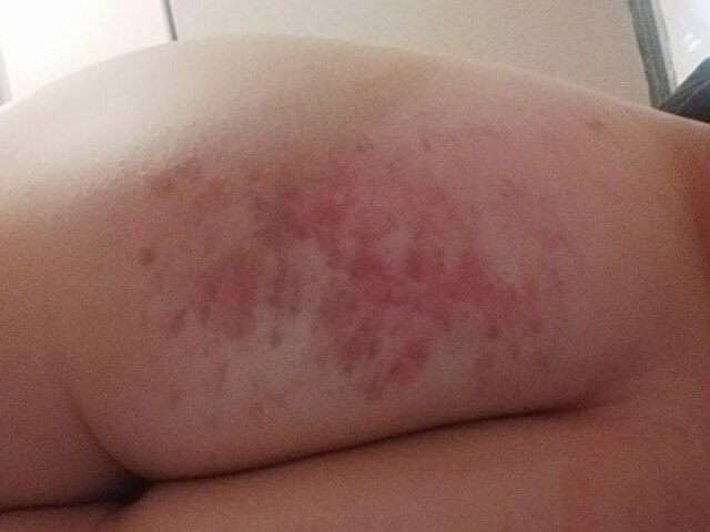 Perfil con Vaiola - Imagen  n°7